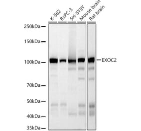 Western Blot - Anti-EXOC2 Antibody [ARC3126] (A329351) - Antibodies.com