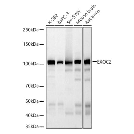 Western Blot - Anti-EXOC2 Antibody [ARC3126] (A329351) - Antibodies.com