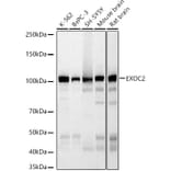Western Blot - Anti-EXOC2 Antibody [ARC3126] (A329351) - Antibodies.com