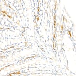 Immunohistochemistry - Anti-F4/80 Antibody [ARC61555] (A329353) - Antibodies.com