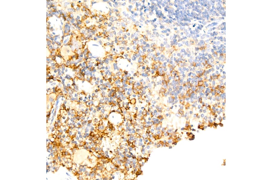 Immunohistochemistry - Anti-F4/80 Antibody [ARC61555] (A329353) - Antibodies.com