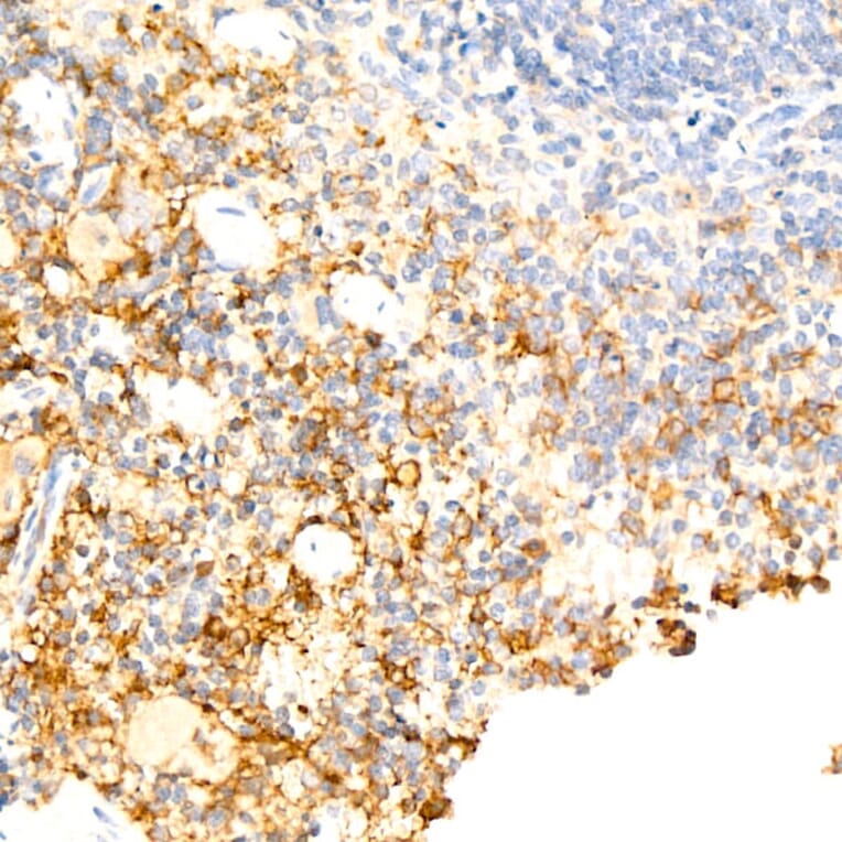 Immunohistochemistry - Anti-F4/80 Antibody [ARC61555] (A329353) - Antibodies.com