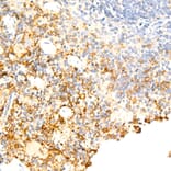 Immunohistochemistry - Anti-F4/80 Antibody [ARC61555] (A329353) - Antibodies.com