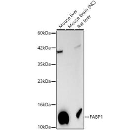 Western Blot - Anti-FABP1 Antibody (A329354) - Antibodies.com