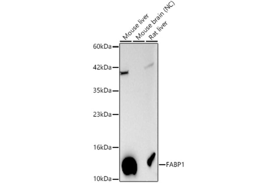 Western Blot - Anti-FABP1 Antibody (A329354) - Antibodies.com