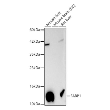 Western Blot - Anti-FABP1 Antibody (A329354) - Antibodies.com