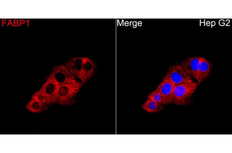 Immunofluorescence - Anti-FABP1 Antibody (A329354) - Antibodies.com