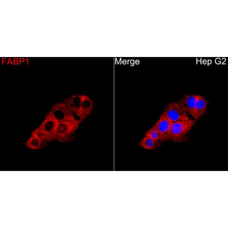 Immunofluorescence - Anti-FABP1 Antibody (A329354) - Antibodies.com