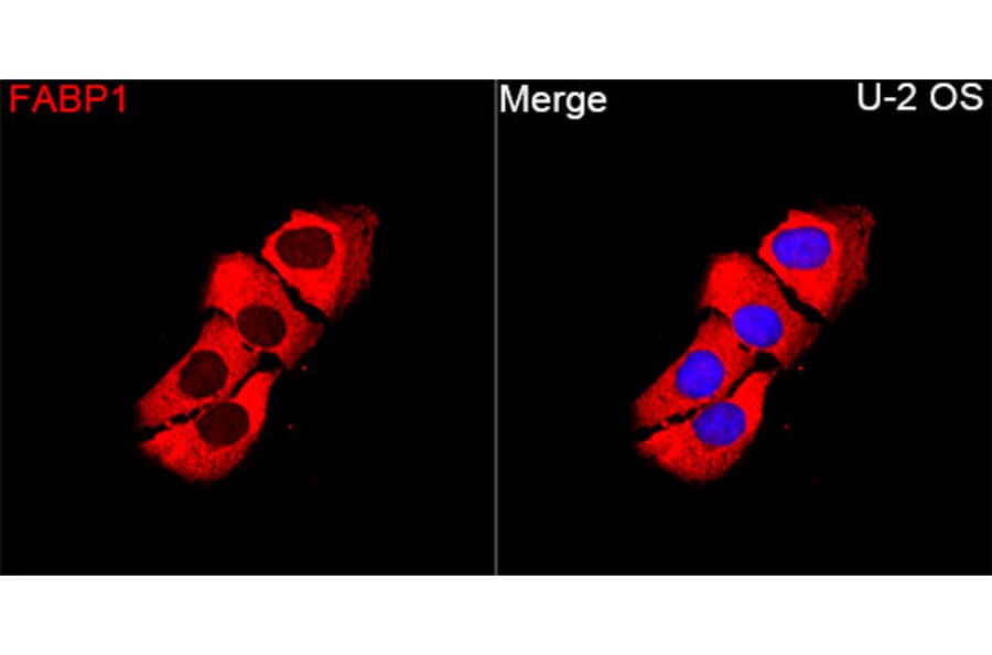 Immunofluorescence - Anti-FABP1 Antibody (A329354) - Antibodies.com