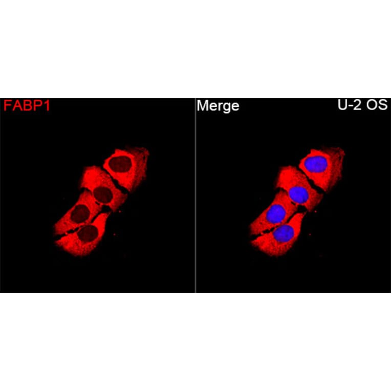 Immunofluorescence - Anti-FABP1 Antibody (A329354) - Antibodies.com