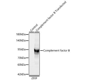 Western Blot - Anti-Factor B Antibody (A329355) - Antibodies.com