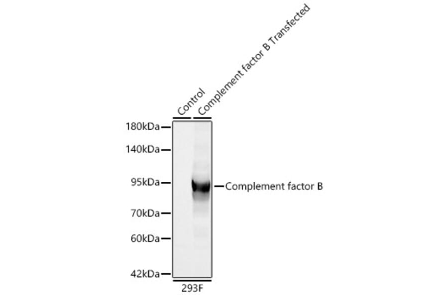 Western Blot - Anti-Factor B Antibody (A329355) - Antibodies.com