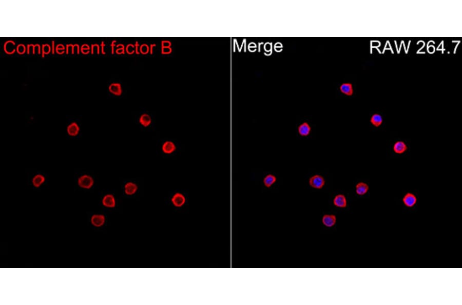 Immunofluorescence - Anti-Factor B Antibody (A329355) - Antibodies.com