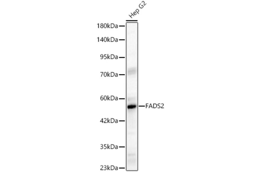 Western Blot - Anti-FADS2 Antibody (A329356) - Antibodies.com
