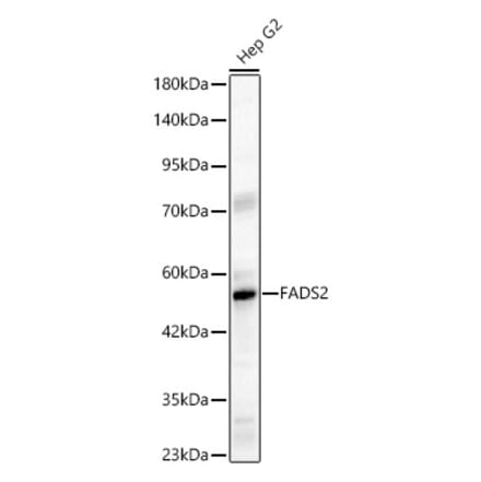 Western Blot - Anti-FADS2 Antibody (A329356) - Antibodies.com