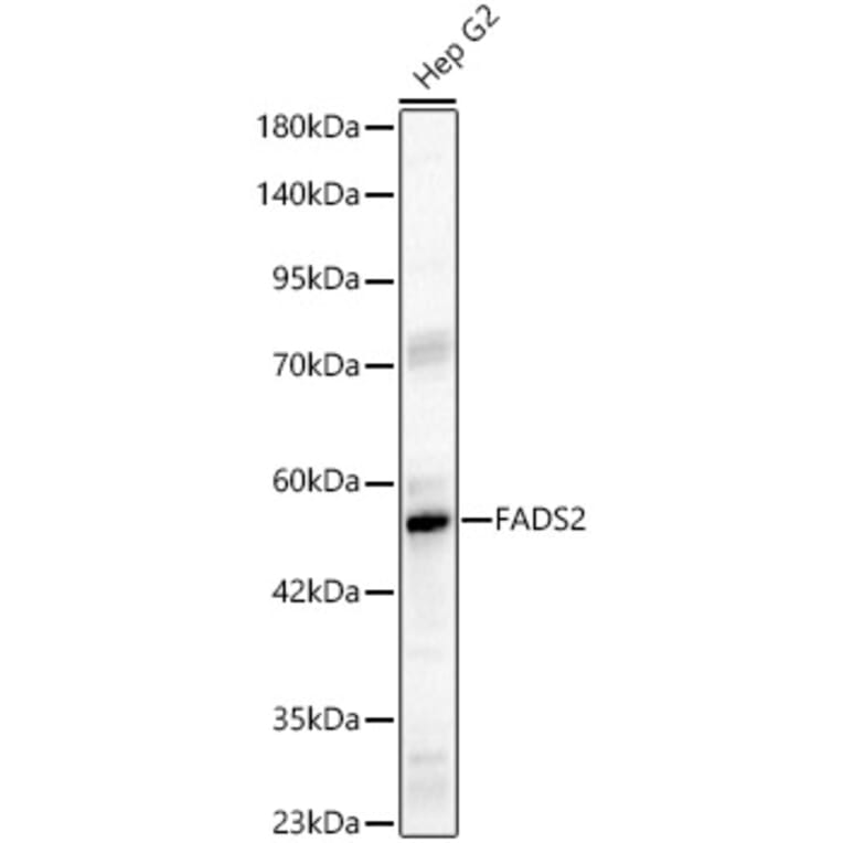 Western Blot - Anti-FADS2 Antibody (A329356) - Antibodies.com