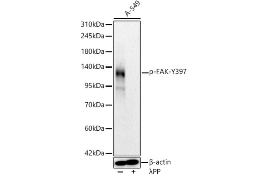 Western Blot - Anti-FAK (Phospho Y397) Antibody [ARC62271] (A329357) - Antibodies.com