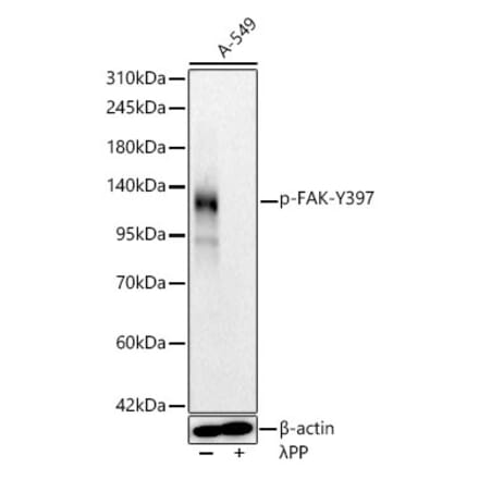 Western Blot - Anti-FAK (Phospho Y397) Antibody [ARC62271] (A329357) - Antibodies.com