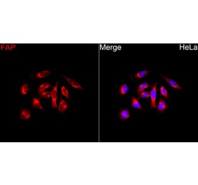 Immunofluorescence - Anti-FAP Antibody (A329363) - Antibodies.com