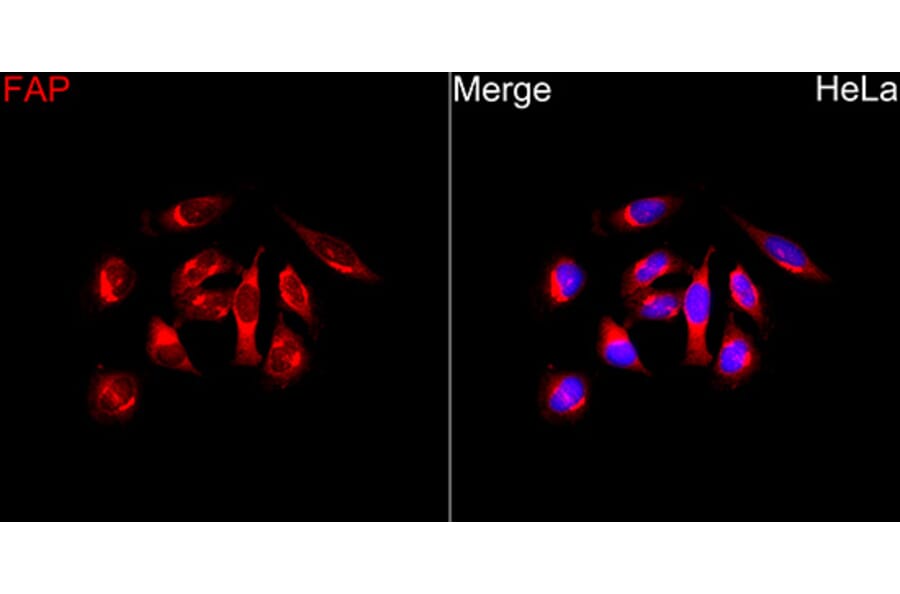 Immunofluorescence - Anti-FAP Antibody (A329363) - Antibodies.com