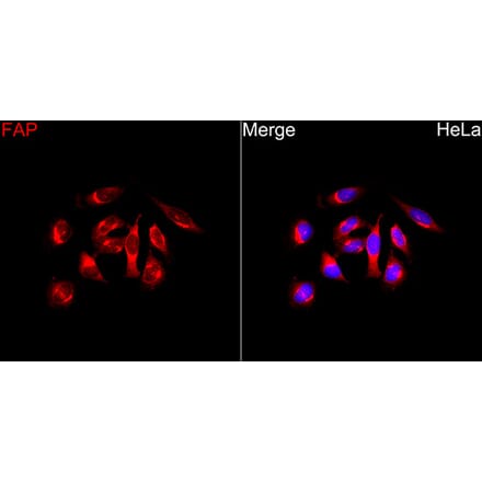 Immunofluorescence - Anti-FAP Antibody (A329363) - Antibodies.com