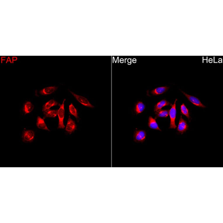 Immunofluorescence - Anti-FAP Antibody (A329363) - Antibodies.com