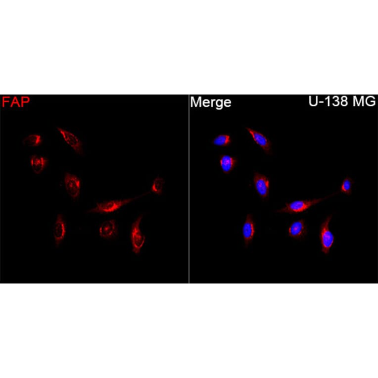Immunofluorescence - Anti-FAP Antibody (A329363) - Antibodies.com