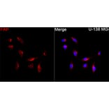 Immunofluorescence - Anti-FAP Antibody (A329363) - Antibodies.com