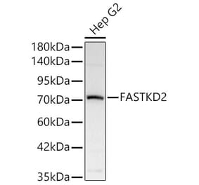 Western Blot - Anti-FASTKD2 Antibody (A329364) - Antibodies.com