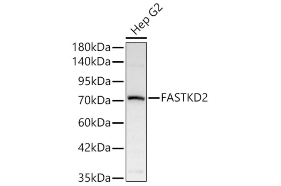 Western Blot - Anti-FASTKD2 Antibody (A329364) - Antibodies.com