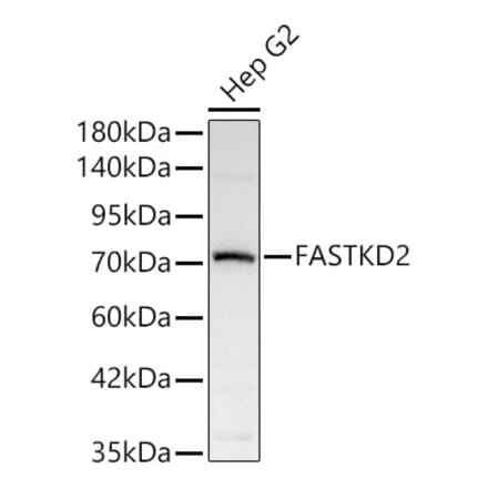 Western Blot - Anti-FASTKD2 Antibody (A329364) - Antibodies.com