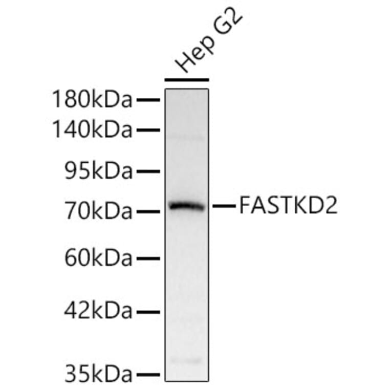 Western Blot - Anti-FASTKD2 Antibody (A329364) - Antibodies.com