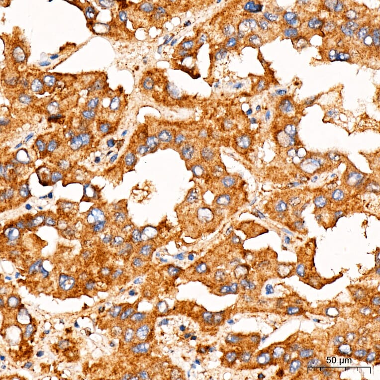 Immunohistochemistry - Anti-FASTKD2 Antibody (A329364) - Antibodies.com