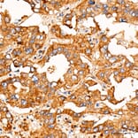 Immunohistochemistry - Anti-FASTKD2 Antibody (A329364) - Antibodies.com