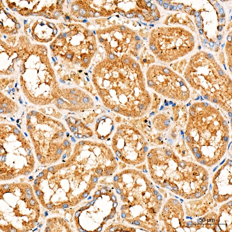 Immunohistochemistry - Anti-FASTKD2 Antibody (A329364) - Antibodies.com