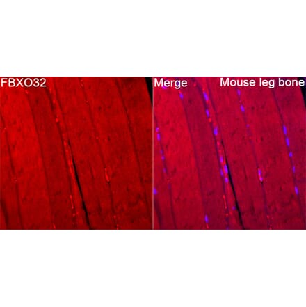 Immunofluorescence - Anti-Fbx32 Antibody (A329365) - Antibodies.com