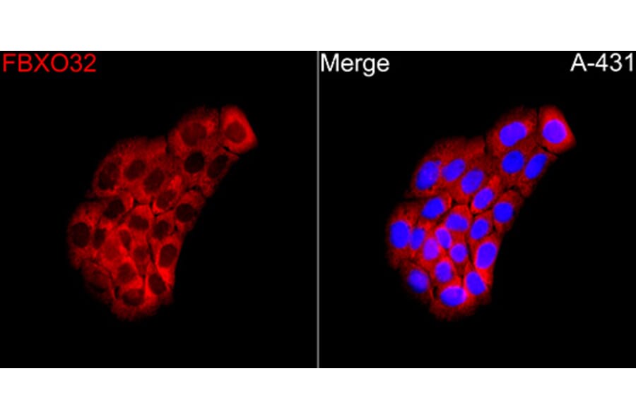 Immunofluorescence - Anti-Fbx32 Antibody (A329365) - Antibodies.com