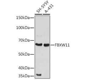 Western Blot - Anti-FBXW11 Antibody (A329366) - Antibodies.com