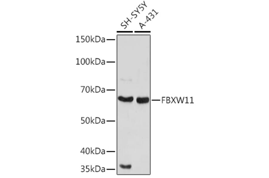 Western Blot - Anti-FBXW11 Antibody (A329366) - Antibodies.com