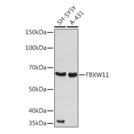 Western Blot - Anti-FBXW11 Antibody (A329366) - Antibodies.com