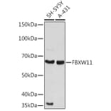 Western Blot - Anti-FBXW11 Antibody (A329366) - Antibodies.com