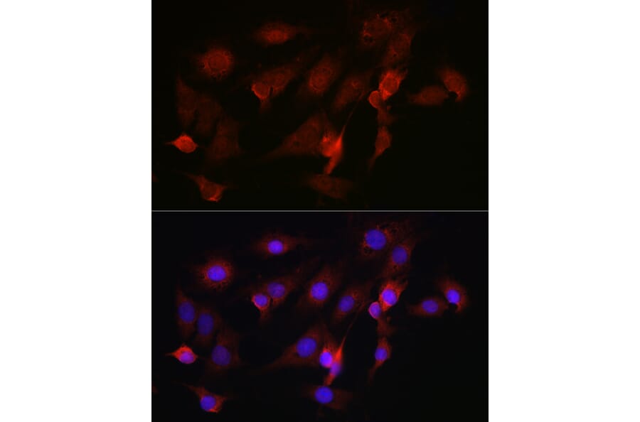 Immunofluorescence - Anti-FBXW11 Antibody (A329366) - Antibodies.com