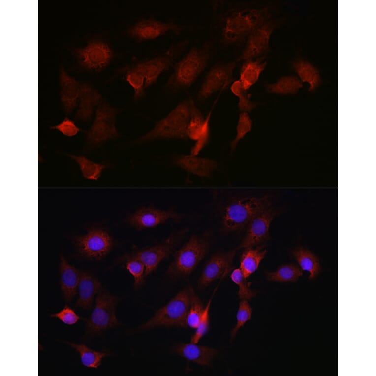 Immunofluorescence - Anti-FBXW11 Antibody (A329366) - Antibodies.com