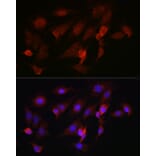 Immunofluorescence - Anti-FBXW11 Antibody (A329366) - Antibodies.com