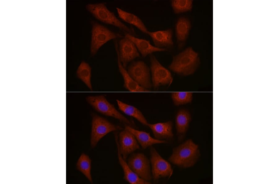 Immunofluorescence - Anti-FBXW11 Antibody (A329366) - Antibodies.com