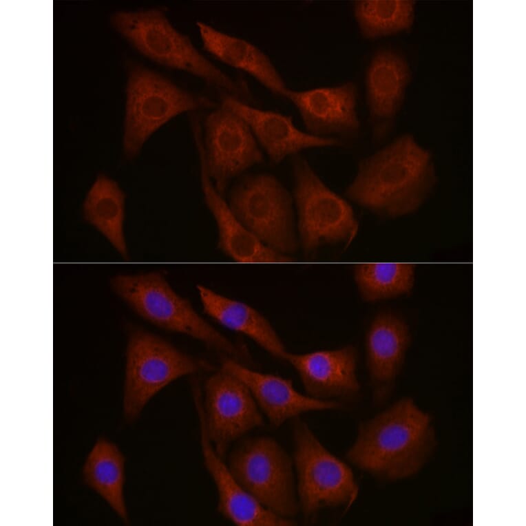 Immunofluorescence - Anti-FBXW11 Antibody (A329366) - Antibodies.com