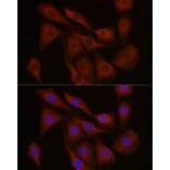 Immunofluorescence - Anti-FBXW11 Antibody (A329366) - Antibodies.com