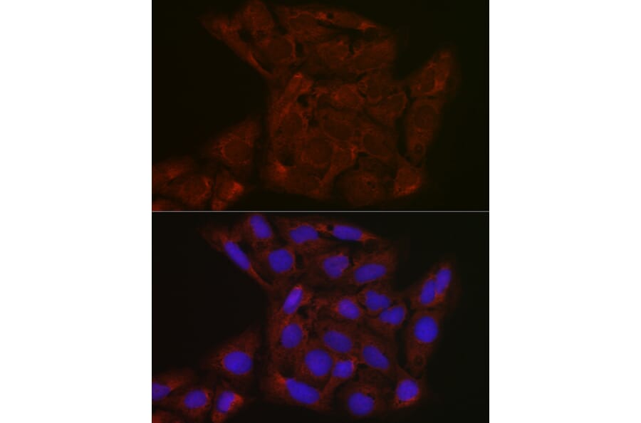 Immunofluorescence - Anti-FBXW11 Antibody (A329366) - Antibodies.com