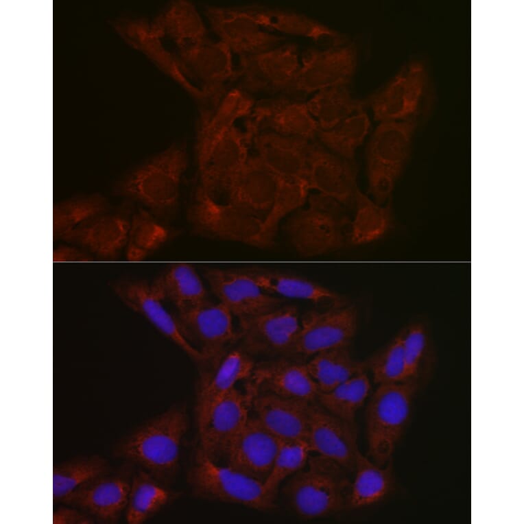 Immunofluorescence - Anti-FBXW11 Antibody (A329366) - Antibodies.com