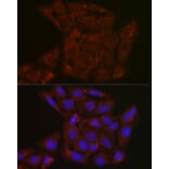 Immunofluorescence - Anti-FBXW11 Antibody (A329366) - Antibodies.com